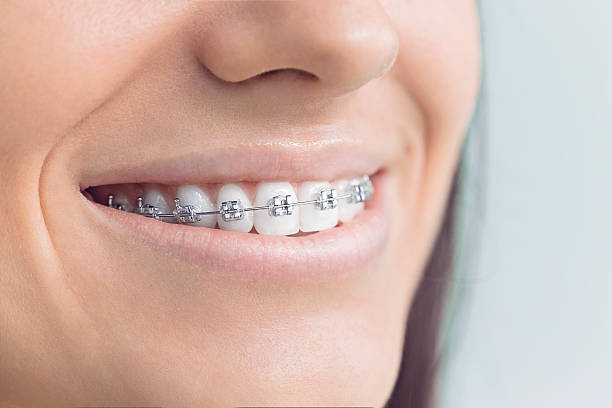 Best Dental Fillings (Composite and Amalgam)  in Bradford, OH