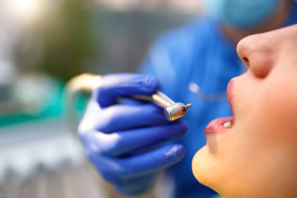Best Wisdom Tooth Removal  in Bradford, OH